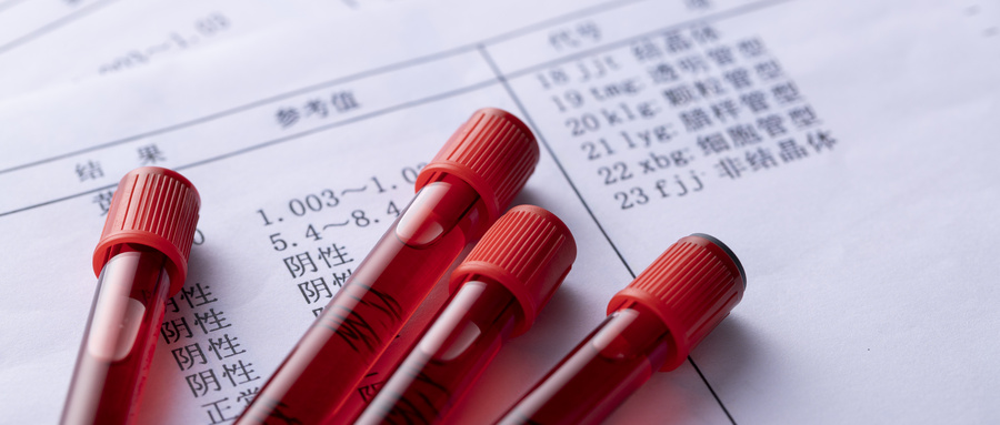 女人做梦梦见血预示着什么