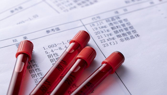 做梦梦见血是什么意思