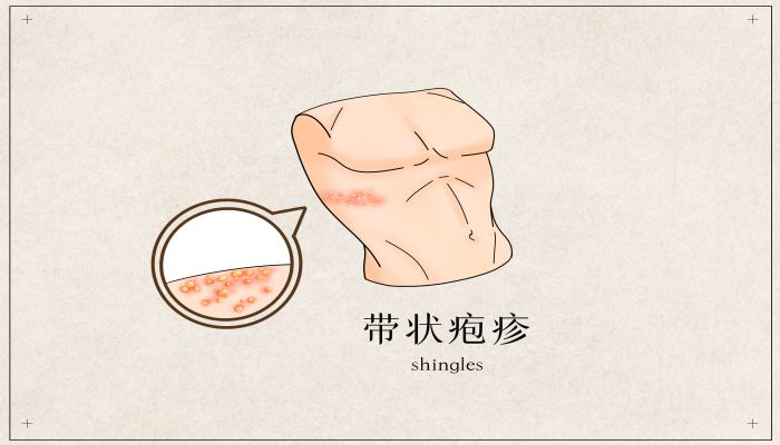 做梦梦见水泡是什么意思 做梦梦见水泡是什么预兆