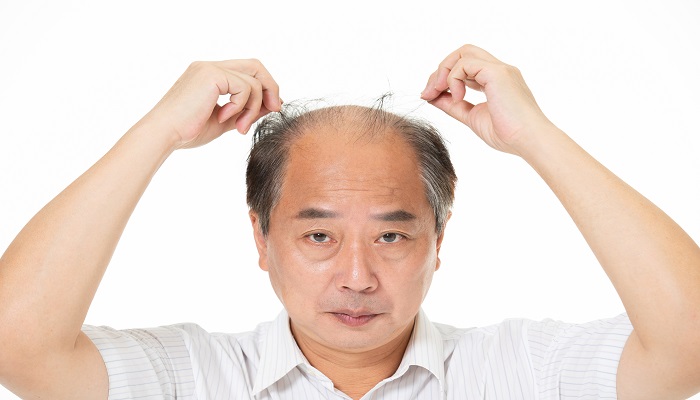 做梦梦见死去的人是什么意思 做梦梦见死去的人有什么预兆