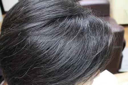 做梦梦见白头发什么意思