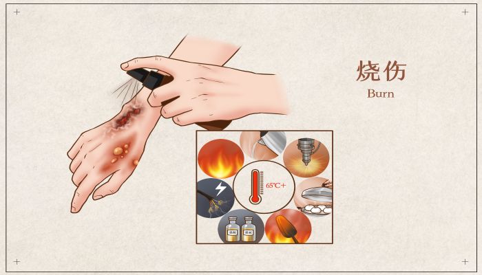 做梦梦见水泡是什么意思 做梦梦见水泡是什么预兆