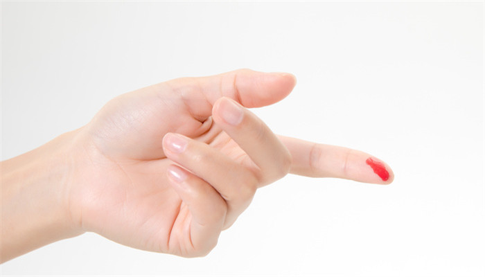 做梦梦见别人打架见血了