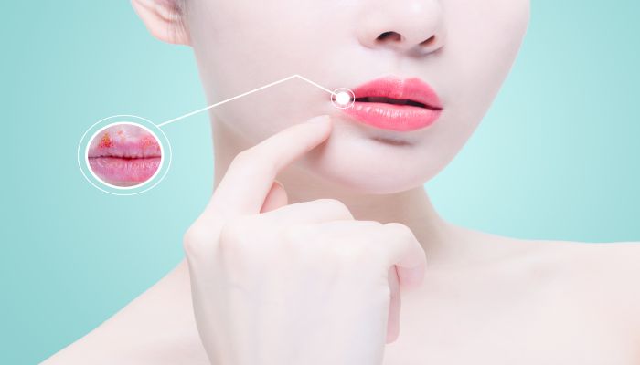 做梦梦见溃疡是什么意思 做梦梦见溃疡是什么预兆