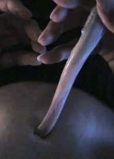 饥饿症